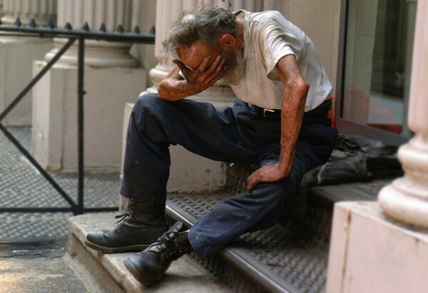 older man dehydrated bad skin homeless alcohol negatively impacts health