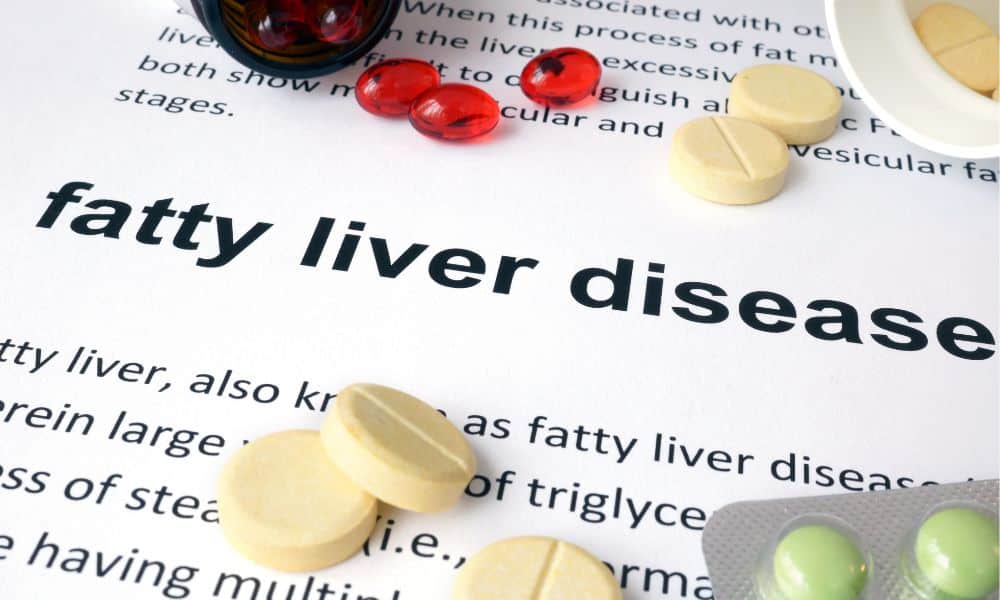 Fatty Liver - How to Best Recognize and Get Rid of It