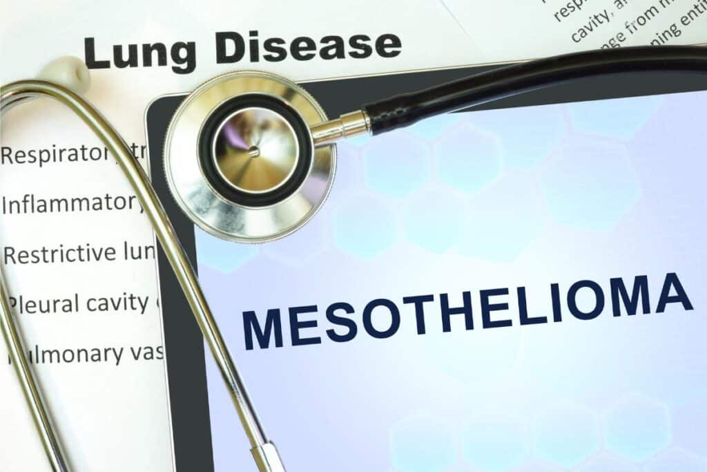 Understanding Mesothelioma: Causes, Symptoms, Natural Remedies, and Diet